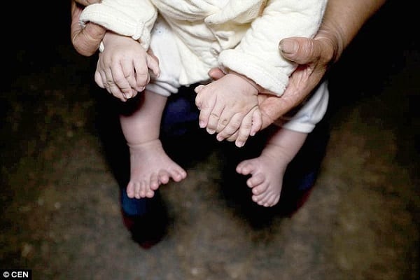 Un bébé chinois naît avec 15 doigts et 16 orteils: PHOTOS