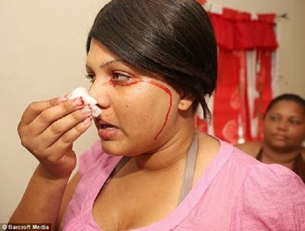 République dominicaine: Une adolescente pleure et sue du sang (photos)