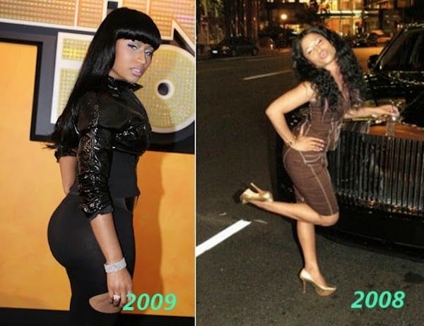 Beyoncé, Lady Gaga, Rihanna, Nicki M… les célébrités avant et après la chirurgie esthétique !