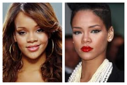 Beyoncé, Lady Gaga, Rihanna, Nicki M… les célébrités avant et après la chirurgie esthétique !