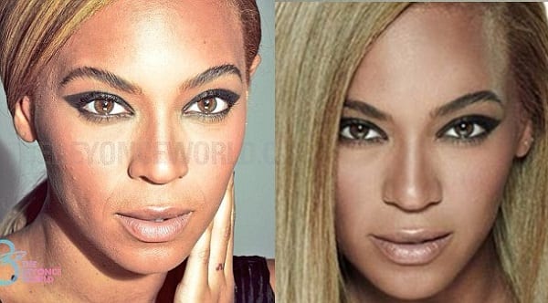  Beyoncé: ses photos non retouchées avec un visage boutonneux qui choquent!