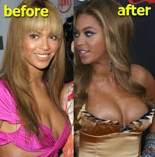 Beyoncé avant et après la chirurgie esthétique