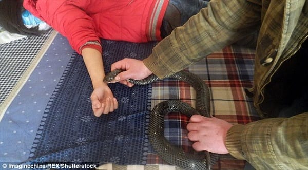 Chine: Une fillette échappe à la mort après une morsure au poignet d'un cobra pour soigner son anémie: PHOTOS